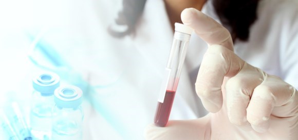 בדיקת ברזל (Iron) - תמונה